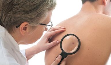 Virus ljudskog papiloma kod muškaraca