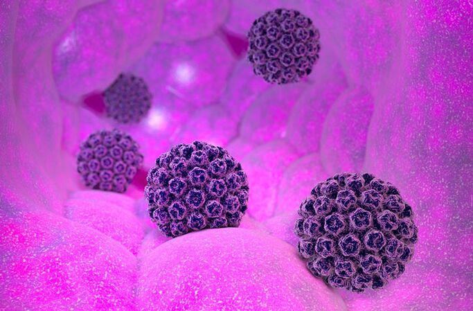 Humani papiloma virus s onkogenim i neonkogenim genotipovima