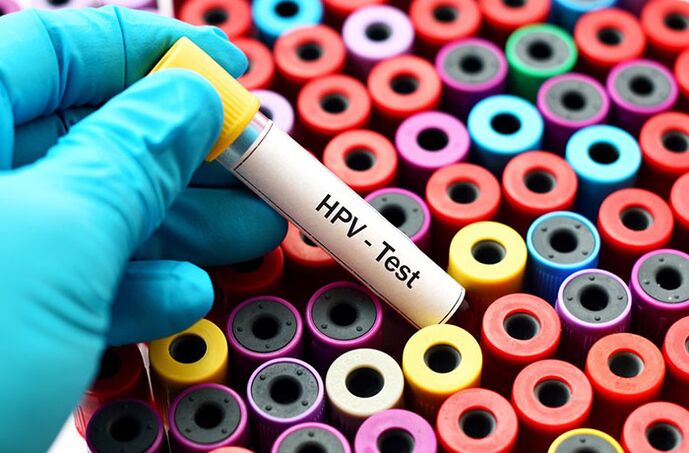 Test krvi na ljudski papiloma virus